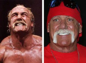 hulk hogan fake teeth